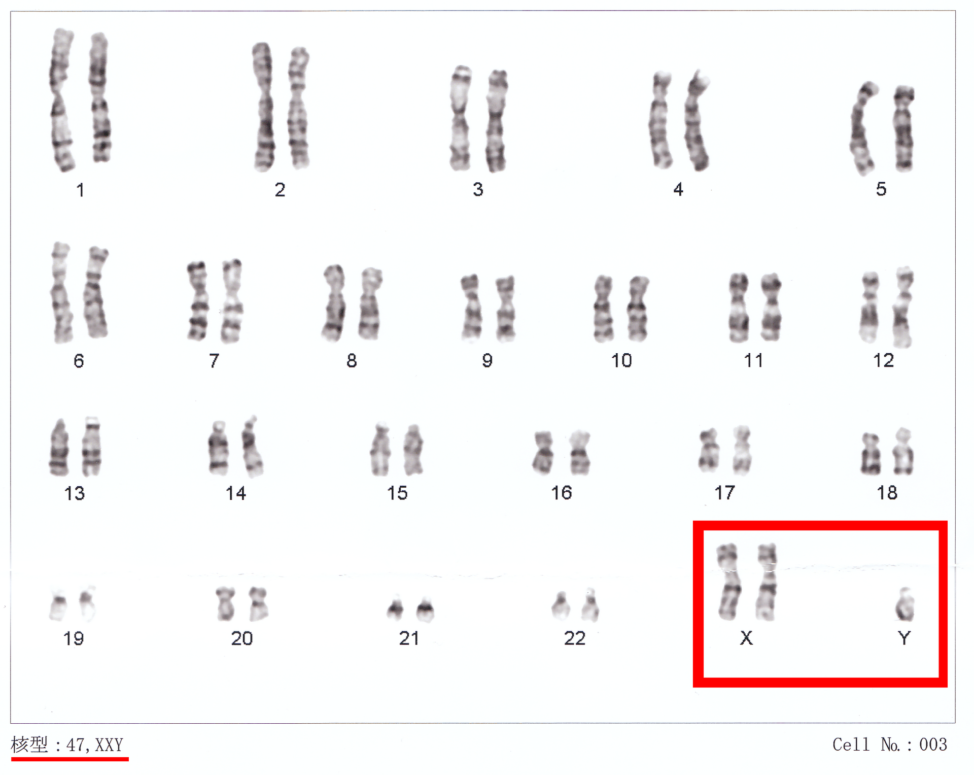 A scan of human chromosomes, with a red box around the X and Y pair, showing two X's.